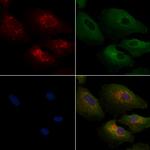 GNAI3 Polyclonal Antibody