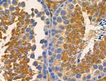 GNAI3 Antibody in Immunohistochemistry (Paraffin) (IHC (P))
