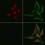 GNAL Polyclonal Antibody