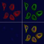 GNL1 Antibody in Immunocytochemistry (ICC/IF)