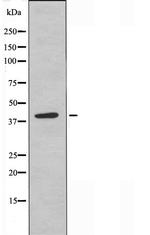 HLA-H Antibody in Western Blot (WB)