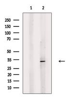 HLA-DOB Polyclonal Antibody