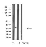 HLA-DPA1 Antibody in Western Blot (WB)