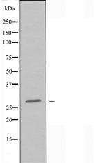Nkx2.6 Antibody in Western Blot (WB)