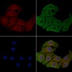 LDLRAD2 Polyclonal Antibody