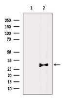 LDLRAD2 Antibody in Western Blot (WB)