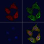 CD206 Polyclonal Antibody