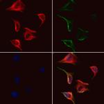 GSDMC Polyclonal Antibody