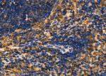 GSDMC Antibody in Immunohistochemistry (Paraffin) (IHC (P))