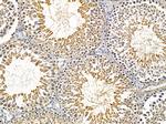 PGRMC2 Antibody in Immunohistochemistry (Paraffin) (IHC (P))