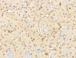 MBTPS1 Antibody in Immunohistochemistry (Paraffin) (IHC (P))