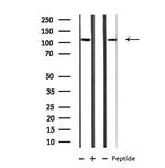 MBTPS1 Antibody in Western Blot (WB)