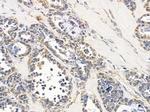 CLNS1A Antibody in Immunohistochemistry (Paraffin) (IHC (P))