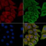 MGST1 Polyclonal Antibody