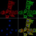 MRPS2 Polyclonal Antibody