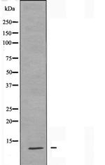 MRPS21 Antibody in Western Blot (WB)