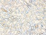SLC25A21 Polyclonal Antibody