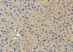 SLC16A2 Polyclonal Antibody