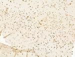 Myeloid Specific Antigen Antibody in Immunohistochemistry (Paraffin) (IHC (P))