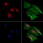 MDFI Polyclonal Antibody