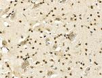 MDFI Antibody in Immunohistochemistry (Paraffin) (IHC (P))