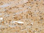 MYOM2 Antibody in Immunohistochemistry (Paraffin) (IHC (P))