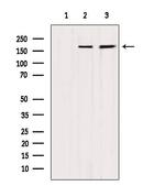 MYOM2 Antibody in Western Blot (WB)