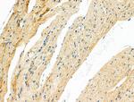 MYH14 Polyclonal Antibody