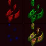 MYBPC1 Polyclonal Antibody