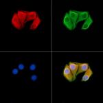 MYO5A Polyclonal Antibody