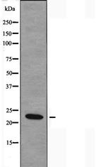 NDUFB9 Polyclonal Antibody