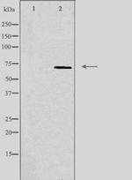 MT-ND5 Antibody in Western Blot (WB)