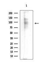N4BP1 Polyclonal Antibody