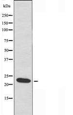 NMS Polyclonal Antibody