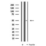 CHRNA10 Antibody in Western Blot (WB)