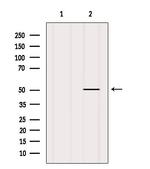 CHRNA10 Antibody in Western Blot (WB)