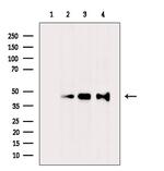 NTM Polyclonal Antibody