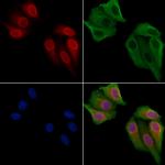 NCOA7 Polyclonal Antibody