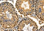 NRBF2 Antibody in Immunohistochemistry (Paraffin) (IHC (P))