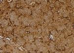 NUTF2 Polyclonal Antibody