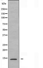 NUTF2 Antibody in Western Blot (WB)