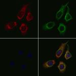 SLC15A1 Polyclonal Antibody