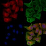 SLC6A15 Polyclonal Antibody