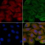 PDRG1 Polyclonal Antibody