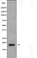 PDRG1 Antibody in Western Blot (WB)