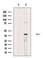 ZDHHC15 Polyclonal Antibody