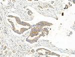 EHHADH Polyclonal Antibody