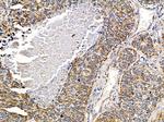 PHACTR4 Polyclonal Antibody