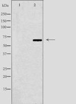 N4BP2L2 Polyclonal Antibody