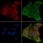 PKP4 Antibody in Immunocytochemistry (ICC/IF)